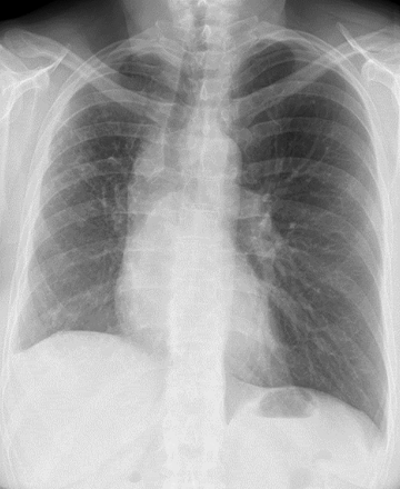 FIGURE 1.