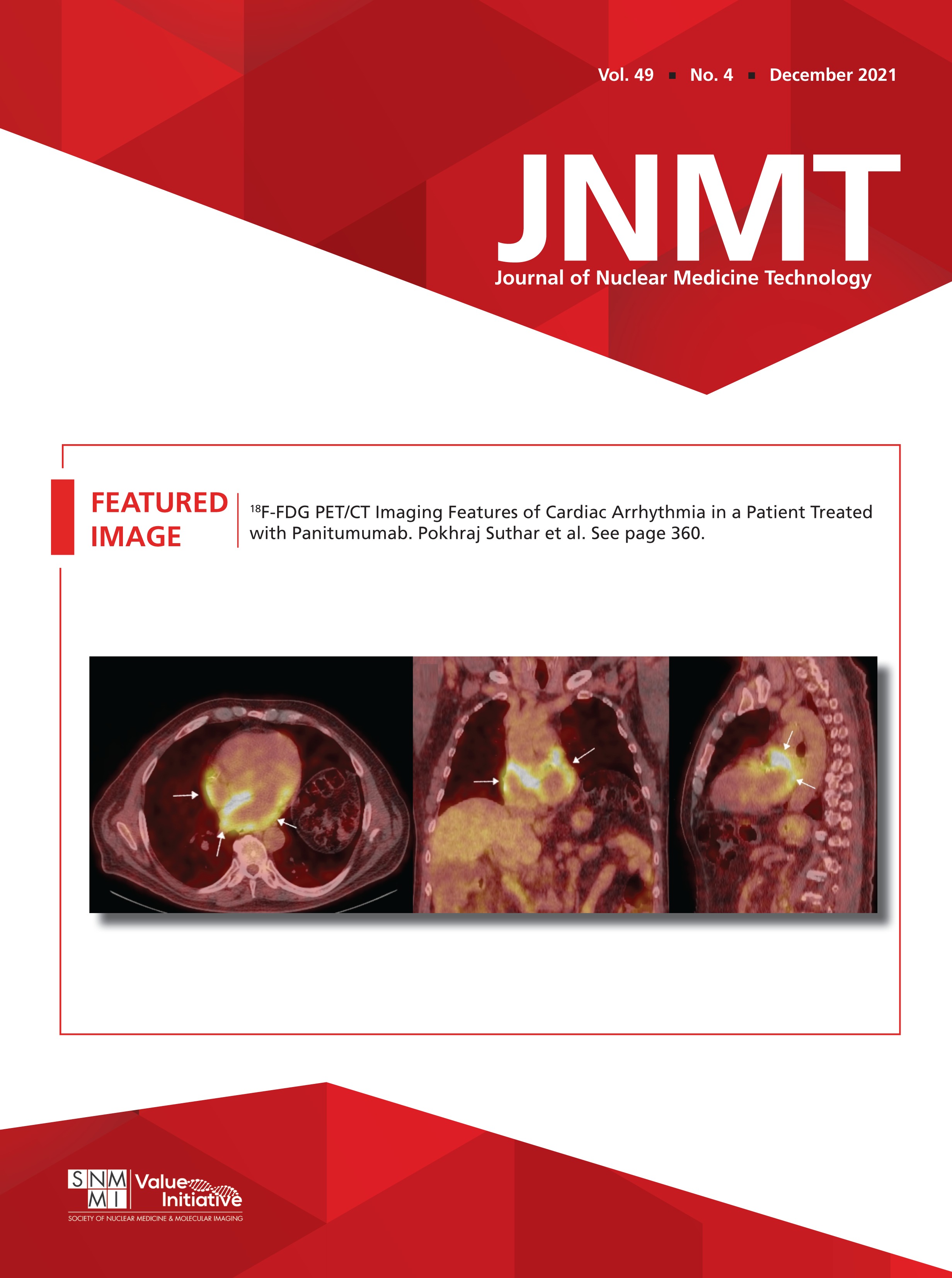 Journal Impact Factor: Do the Numerator and Denominator Need Correction?