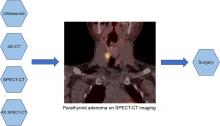 4D SPECT/CT: A Hybrid Approach to Primary Hyperparathyroidism