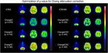 Optimization of the Attenuation Coefficient for Chang Attenuation Correction in <sup>123</sup>I Brain Perfusion SPECT