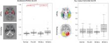 Improved Correlation of <sup>18</sup>F-Flortaucipir PET SUVRs and Clinical Stages in the Alzheimer Disease Continuum with the MUBADA/PERSI-Based Analysis