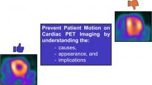 Patient Motion During Cardiac PET Imaging