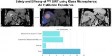 Safety and Efficacy of <sup>90</sup>Y Selective Internal Radiation Therapy Using Glass Microspheres in Hepatocellular Carcinoma: A Southeast Asian Single-Institution Initial Experience