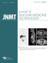 Life's Essential 8 and Poor Brain Health Outcomes in Middle