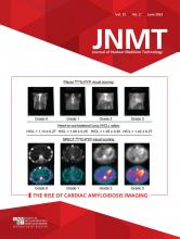 Cardiac Amyloidosis Imaging | Journal of Nuclear Medicine